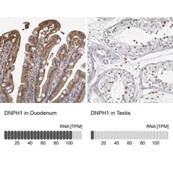 c-Myc-responsive protein Rcl Antibody, Novus Biologicals 0.1mL; Unlabeled:Antibodies,